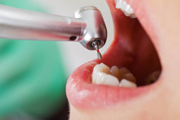 Best Urgent Tooth Repair  in Ballston Spa, NY